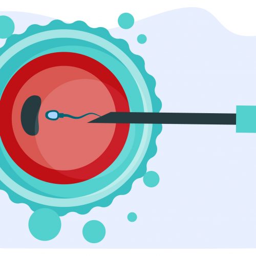 Mikroenjeksiyon, mikroskop ve mikromanüpilatör ile bir iğne içine alınan tek bir sperm hücresinin yumurtanın içine yerleştirilmesidir.