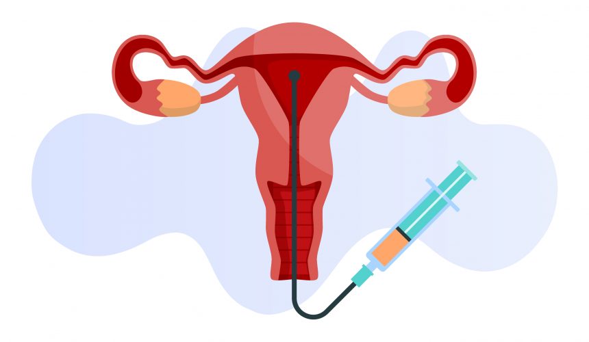 Aşılama, erkeğe bağlı problemin hafif veya sınırda olması, kadında yumurtlamanın yetersiz olması vb. durumlarda pratik ve ekonomik işlemdir.