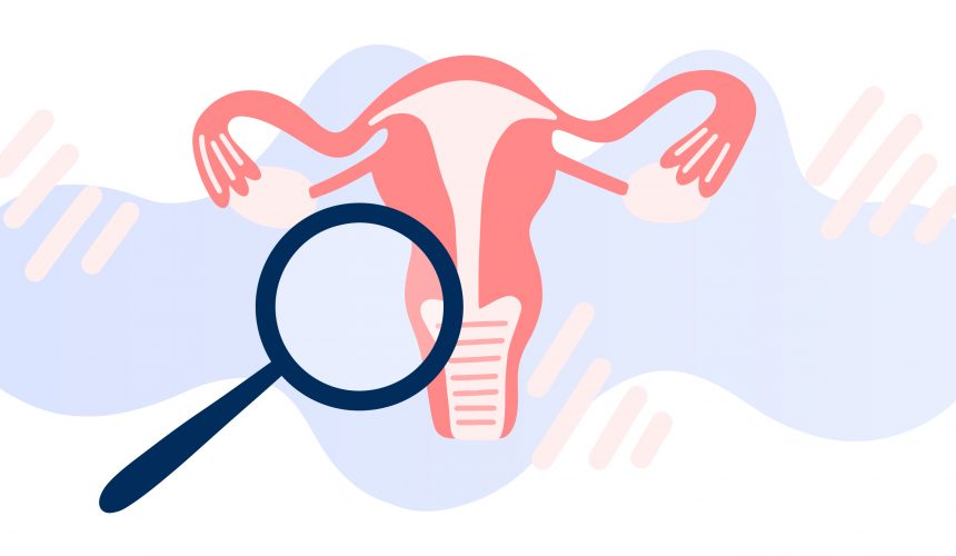 Jinekolojik Problemler