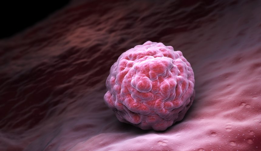 Tüp Bebekte Döllenme ve Embriyo Gelişimi Aşaması Tüp Bebekte Döllenme ve Embriyo Gelişimi Aşaması